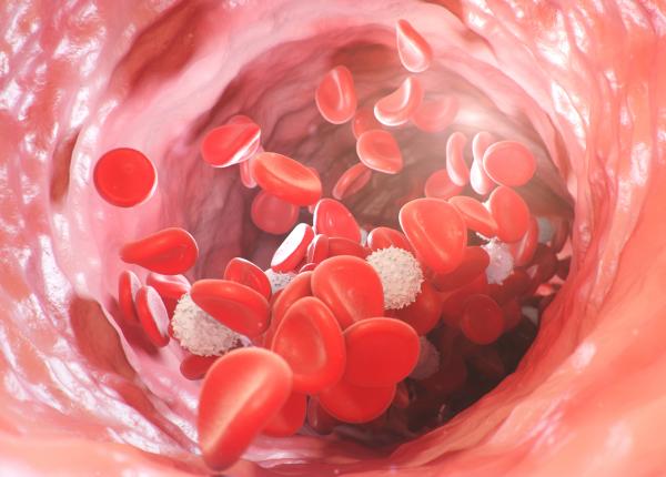 anemie test semn cancer de colon