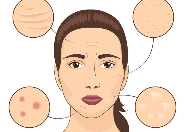 bolile scrise pe fata ta boala de colon acid in corp