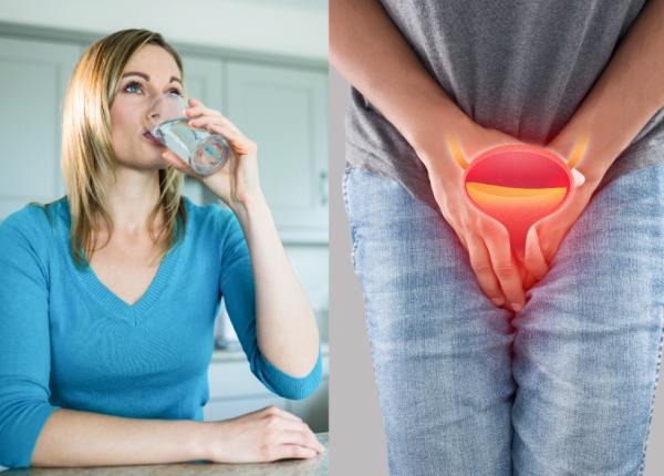 sindromul de jonctiune pielo ureterala tratament simptome sindromul de jonctiune pielo ureterala tratament simptome