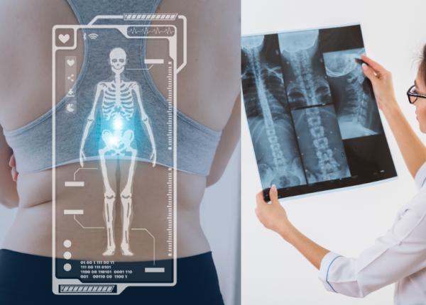 dexa osteodensitometrie 50 de ani valorile normale ale dexa dexa osteodensitometrie 50 de ani valorile normale ale dexa