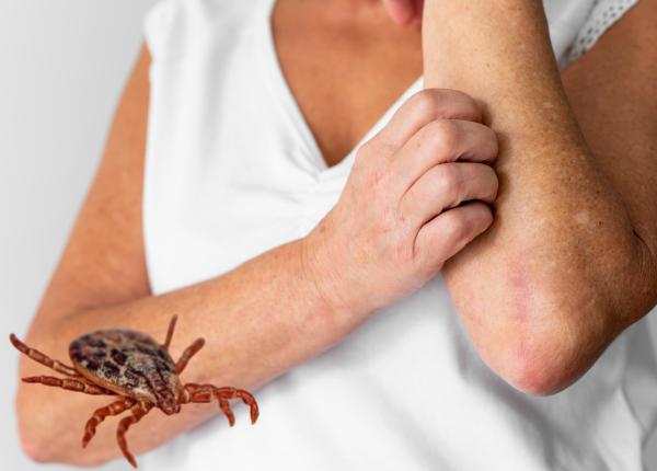 primul semn al boreliozei tudor ciuhodaru eritem boala lyme primul semn al boreliozei tudor ciuhodaru eritem boala lyme