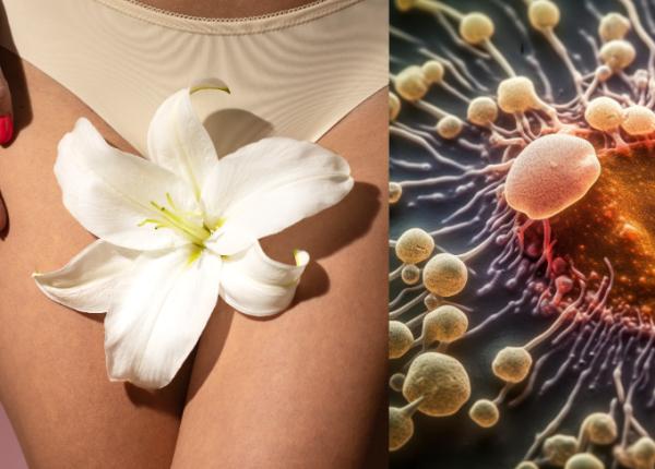 candidoza cauze simptome tratament naturist alimentele care hranesc candida