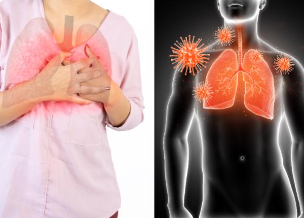 primul semn al cancerului la plamani asculta ti tusea radu cancer bronhopulmonar