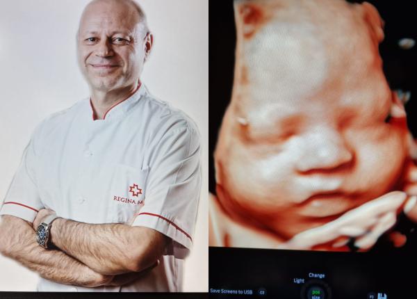 ecograf de ultima generatie in romania george marinescu medicul care lucreaza cu cel mai performant ecograf pe plan mondial ajuta enorm in elucidarea unor probleme de diagnostic