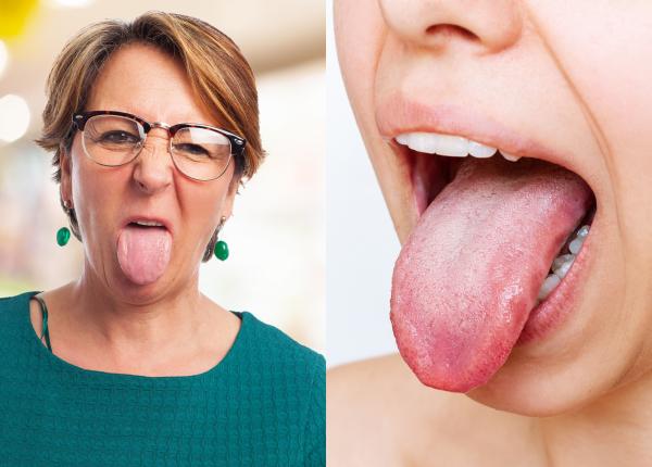 gust amar in gura bolile tratezi