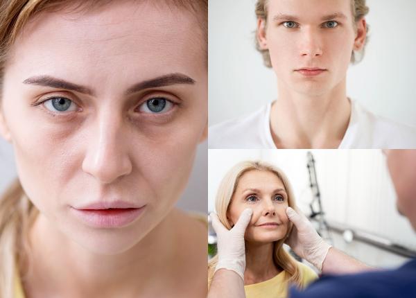 ce boli ai putea avea daca esti mereu palid