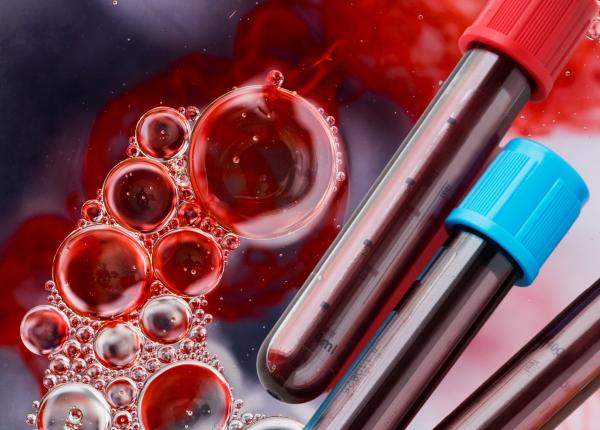 analiza de sange cancer col uterin beatrice anghel tumori local avansate