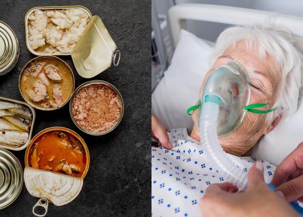 botulismul boala mortala ascunsa in conserve