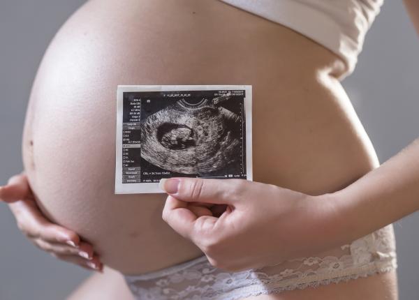 incompatibilitatea rh mame ana maria vayna transfuzia intrauterina anemie