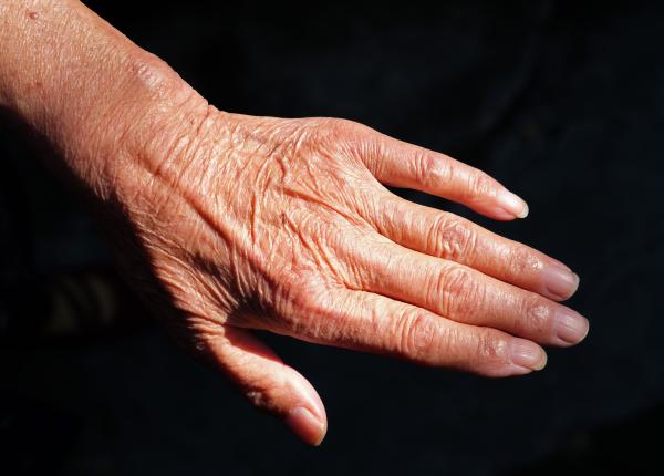 ce inseamna cand mainile au aspect de hartie