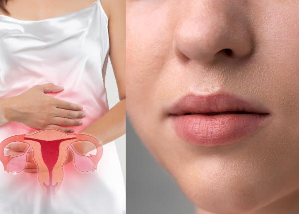 sindromul ovarelor polichistice simptome tratament