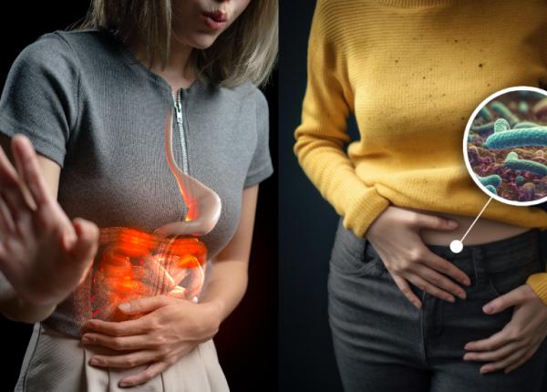 cancer colorectal intoleranta lactoza gluten balonez chimioterapie cancer colorectal intoleranta lactoza gluten balonez chimioterapie