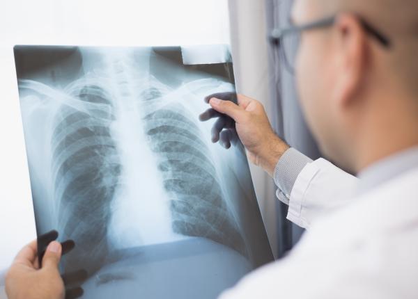 ce este reabilitarea pulmonara si cum se face