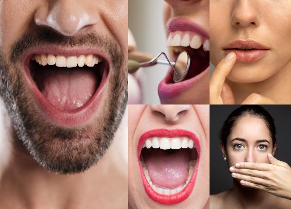 ce indica gura despre sanatatea ta generala