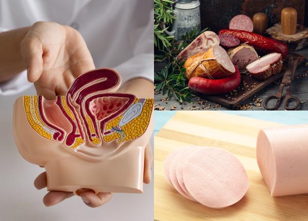 cancerul de colon parizer crenvursti salam carnati