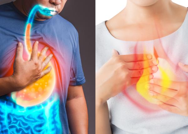 boala de reflux gastroesofagian diagnostic modern