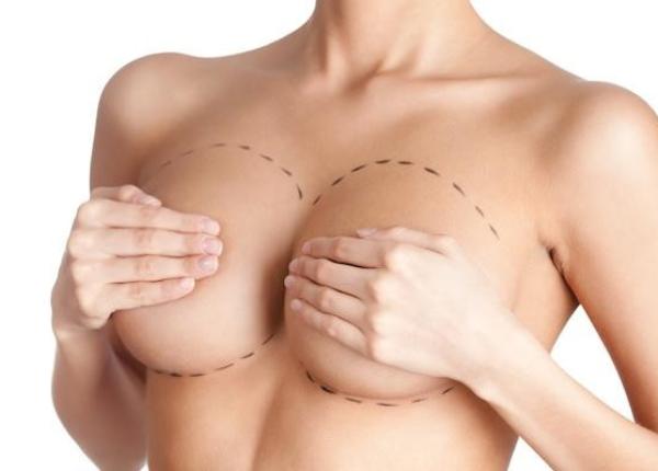 cand este recomandata operatia de reductie mamara