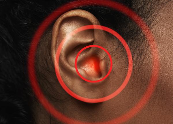 curg urechile secretia galben maro