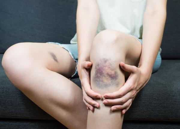 cum sa scapi de vanatai acasa si cand e cazul sa mergi la doctor