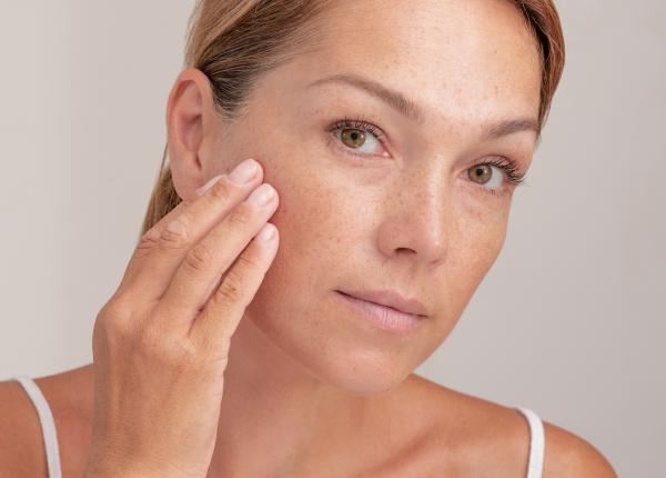 hiperpigmentarea semn al batranetii mihaela bilic hiperpigmentarea semn al batranetii mihaela bilic