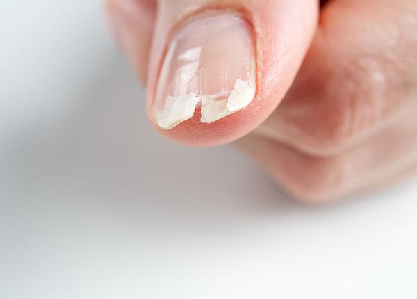 de ce se rup unghiile de ce se rup unghiile