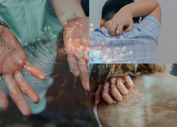 de ce ne mananca pielea de ce ne mananca pielea