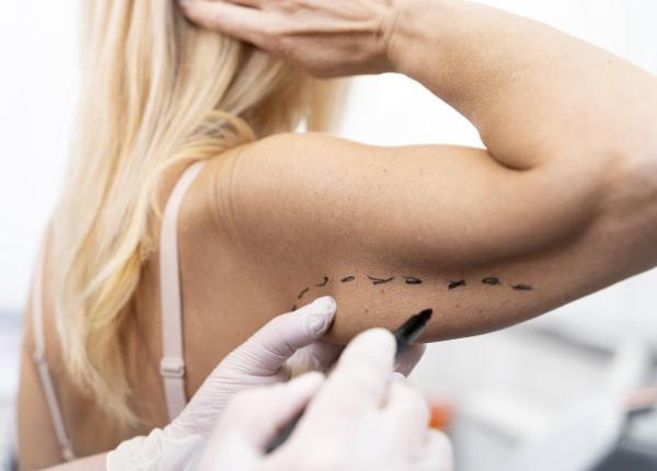 liposuctia ce rol are pentru pacientul cu obezitate dr florin turcu