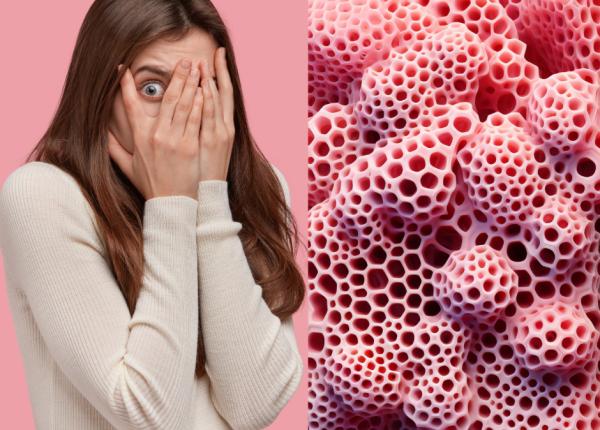 trypophobia ce este simptome cauze si tratament