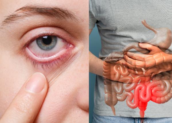 hepatita d primele semne liana gheorghe le ignora hemoragie digestiva icter