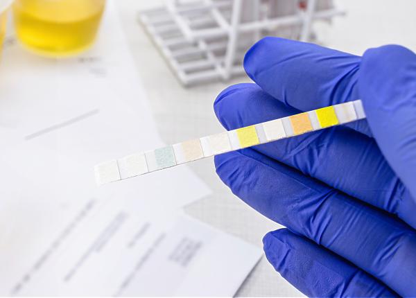 testul hepatita rezultat liana velica hepatita c hepatita b