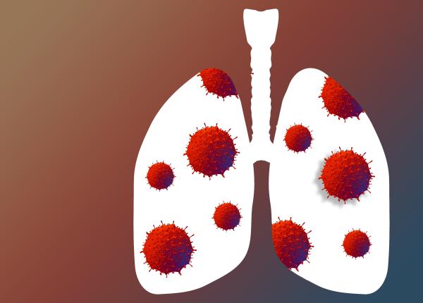 sindromul plamanului alb pneumonie intrebari raspunsuri simptome tuse sputa