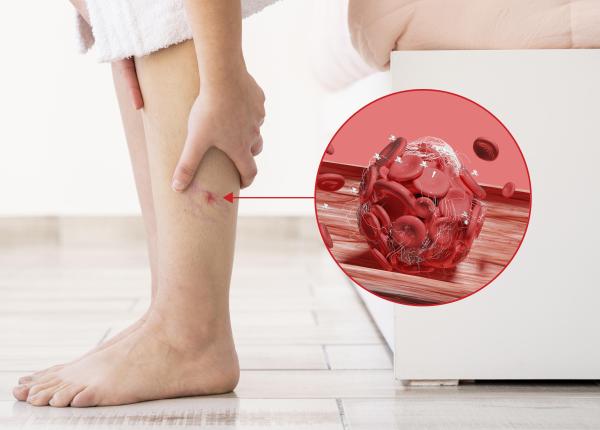 gangrena primul semn ca ai boala arteriala periferica bogdan munteanu durerea este ca un carcel cei mai multi pacienti vin in stadiul patru gangrena primul semn ca ai boala arteriala periferica bogdan munteanu durerea este ca un carcel cei mai multi pacienti vin in stadiul patru