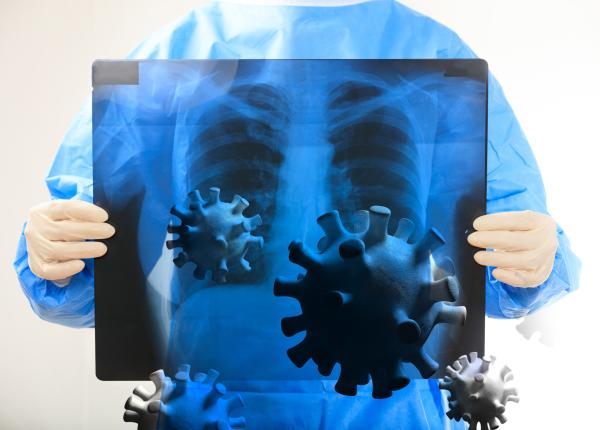 ministerul sanatatii reguli pentru prevenirea limitarea imbolnavirilor de gripa si alte viroze respiratorii la reinceperea scolii