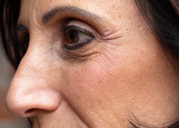 greseala frecventa care duce la aparitia ridurilor