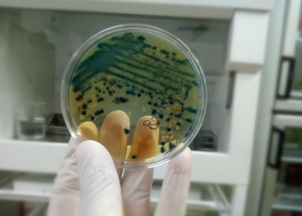 botulism alimentar boala casa aruncati acest aliment ciuhodaru