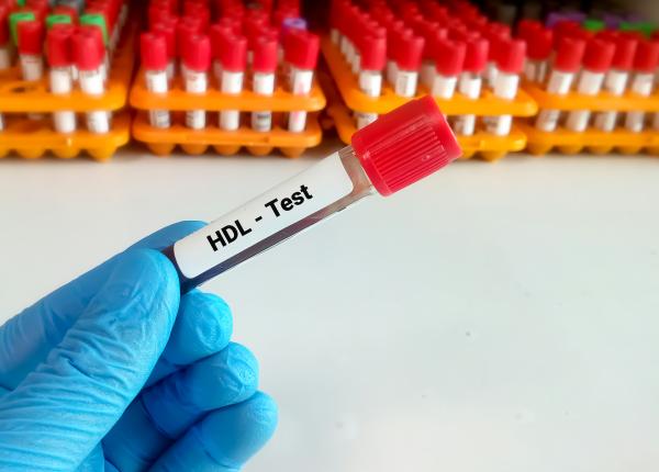 colesterolul hdl scazut creste riscul dezvoltarii boilor de inima ce ar trebui sa faci pentru a creste colesterolul hdl