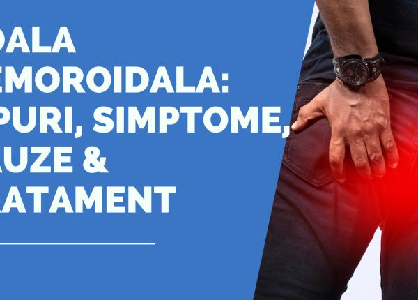 boala hemoroidala tipuri simptome cauze tratament