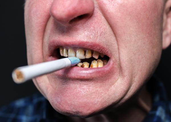 cum sa iti ingrijesti dintii daca fumezi cum sa iti ingrijesti dintii daca fumezi