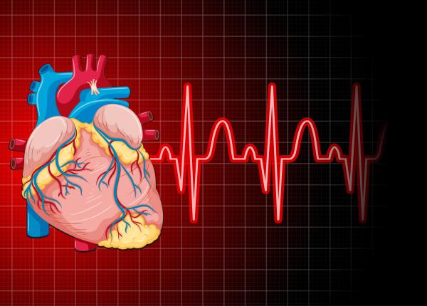 evar si tevar tehnici anevrism rodica niculescu