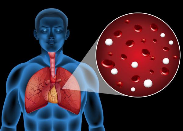 hemoptizia cauze simptome tratament diagnosticul mihuta camil hemoptizia cauze simptome tratament diagnosticul mihuta camil
