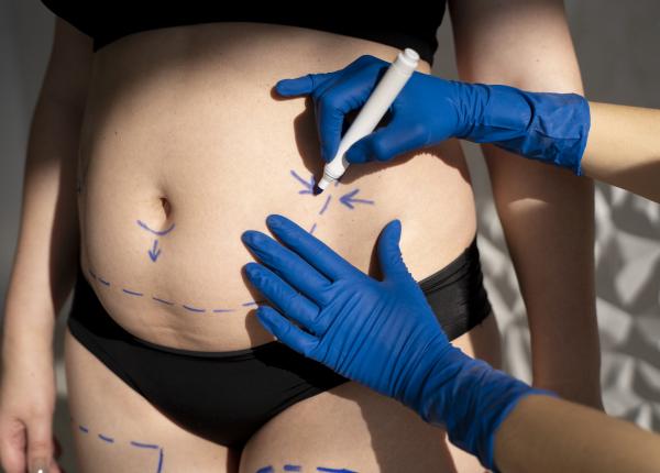 remodelare corporala ce este tehnici andreea tudorache