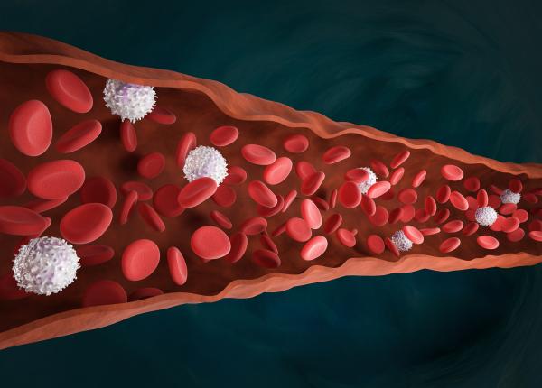 tehnica ce elimina depozitele de calciu de pe vasele de sange