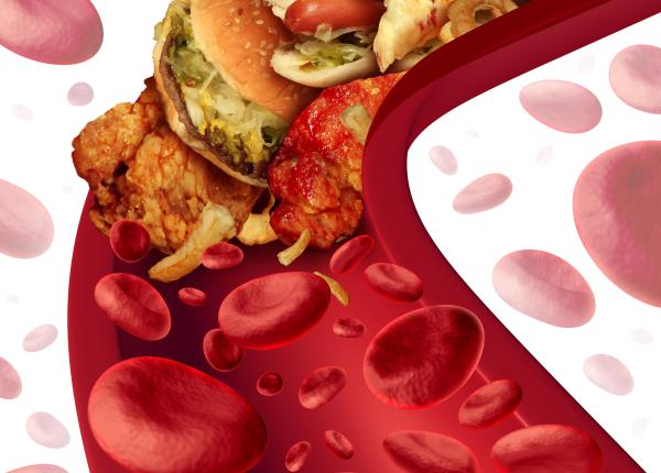 cele mai nocive alimente pentru artere