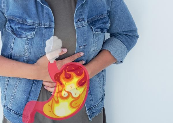 ingredientul care reduce arsurile la stomac bicarbonatul de sodiu