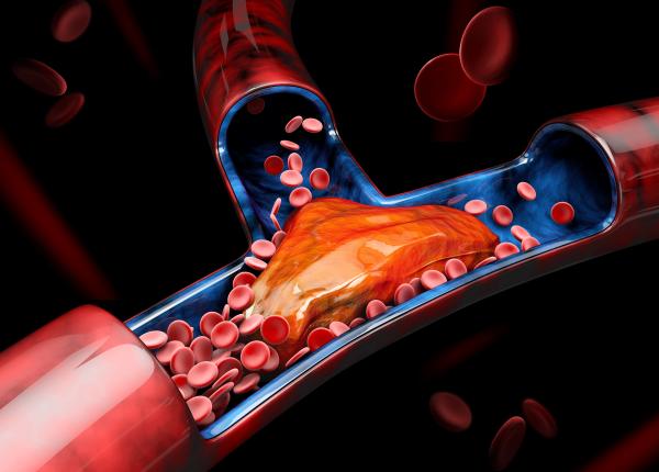 fenomenul care creste nivelul colesterolului rau imbatranirea