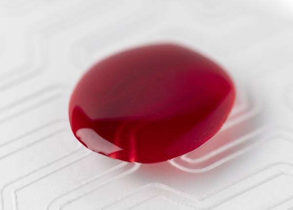 terapia impotriva cancerului de sange adcetris de la pfizer reuseste sa obtina succes intr un studiu in faza avansata terapia impotriva cancerului de sange adcetris de la pfizer reuseste sa obtina succes intr un studiu in faza avansata