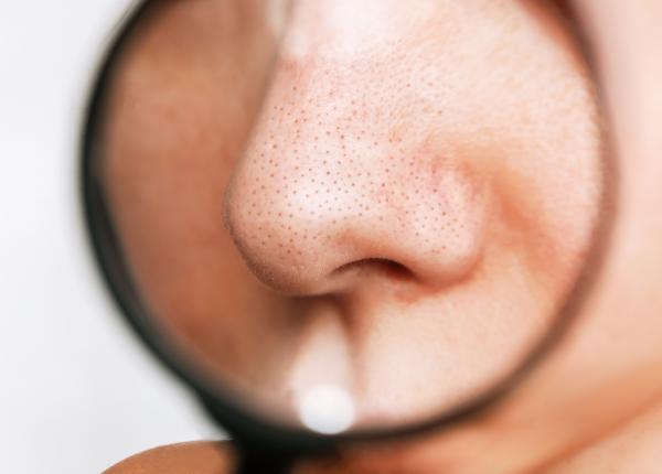 cum sa scapi de punctele negre de pe nas cum sa scapi de punctele negre de pe nas