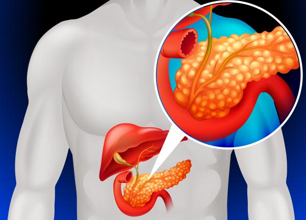 pancreatita primele simptome care apar semnul dat de balonare