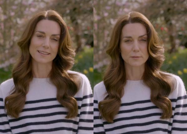 ce este chimioterapia preventiva tratamentul pe care il urmeaza kate middleton dupa diagnosticul de cancer