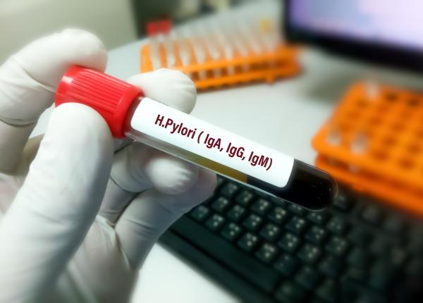 totul despre infectia cu helicobacter pylori